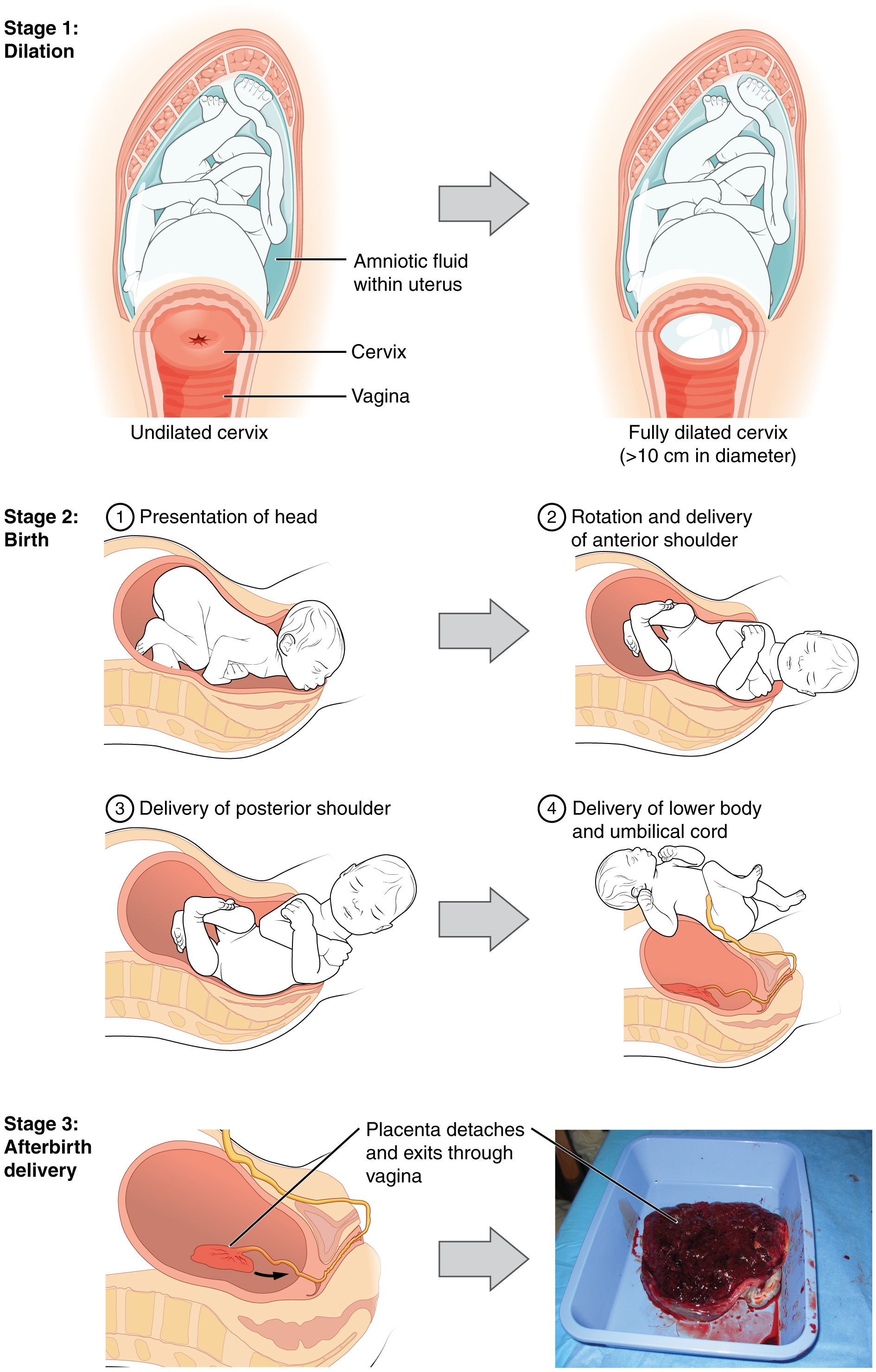 Stages of Childbirth