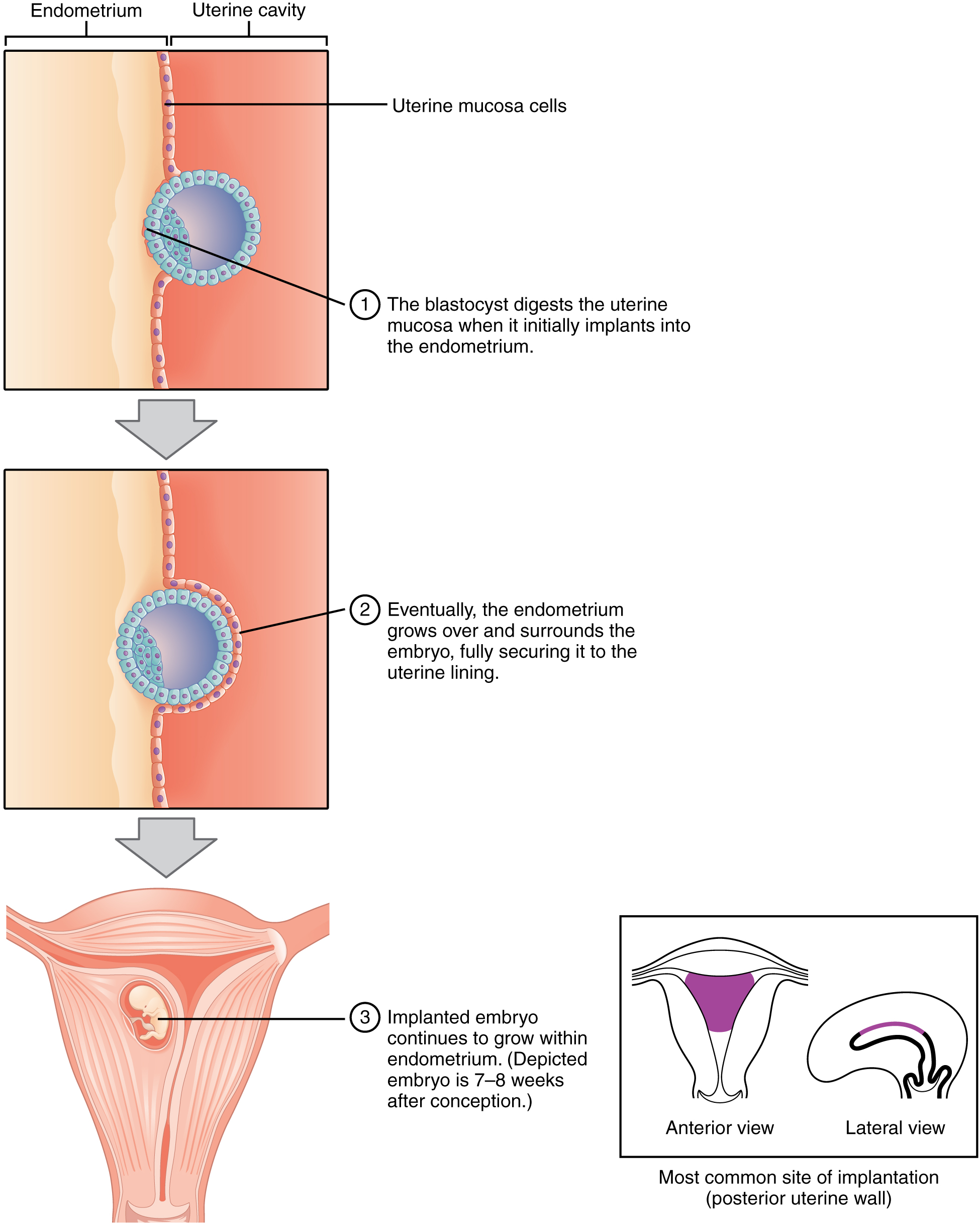 Implantación en útero