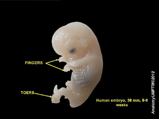 Human embryo