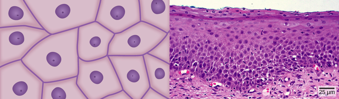 La ilustración A muestra celdas de forma irregular con un núcleo central. La micrografía B muestra una sección transversal de células escamosas del cuello uterino humano. En la capa superior las celdas parecen estar apretadas. En ellos capa media parecen estar más flojamente empaquetados, y en la capa inferior son más planos y alargados.