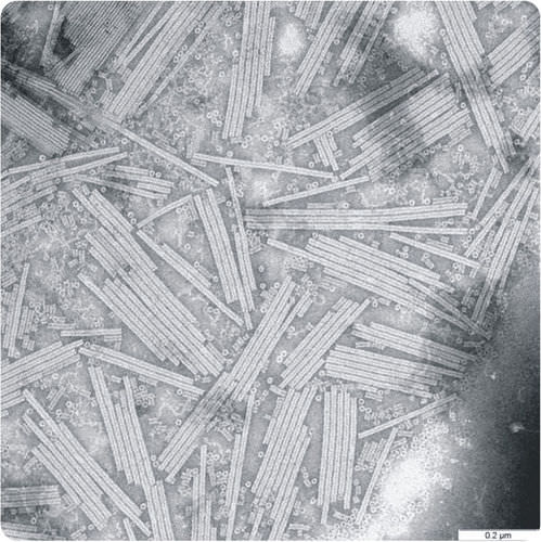 Tobacco Mosaic Virus under a microscope