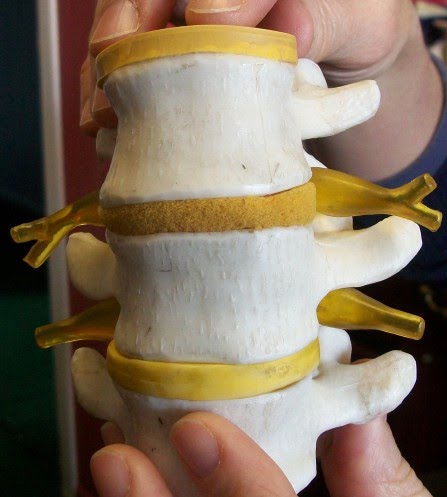 modelo de vértebras con relleno entre cada vértebra