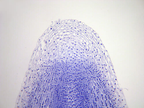 Microfotografía de meristemo apical que se divide rápidamente