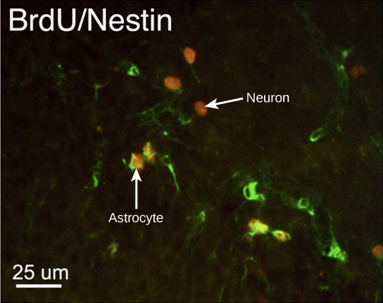 Sur la micrographie, plusieurs cellules sont marquées en vert par fluorescence uniquement. Trois cellules sont étiquetées en rouge uniquement et quatre cellules sont étiquetées en vert et en rouge. Les cellules marquées en vert et en rouge sont des astrocytes, et les cellules marquées en rouge sont des neurones. Les neurones sont ovales et mesurent une dizaine de microns de long. Les astrocytes sont légèrement plus gros et de forme irrégulière.