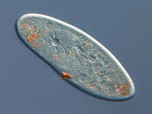 A photo that shows the contractile vacuole within paramecia