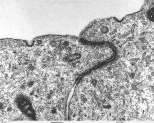 Electron microscope of pinocytosis
