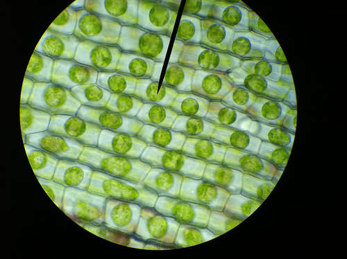 A photo of turgid plant cells