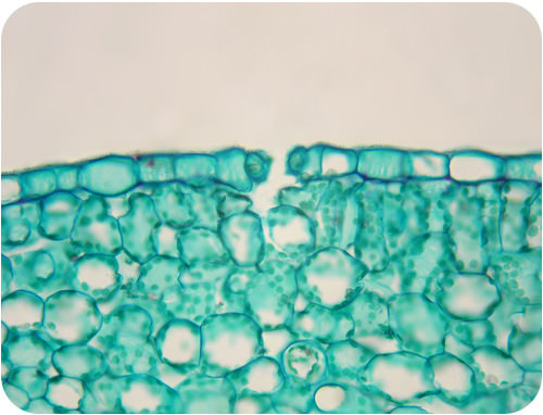 Chloroplasts under a microscope