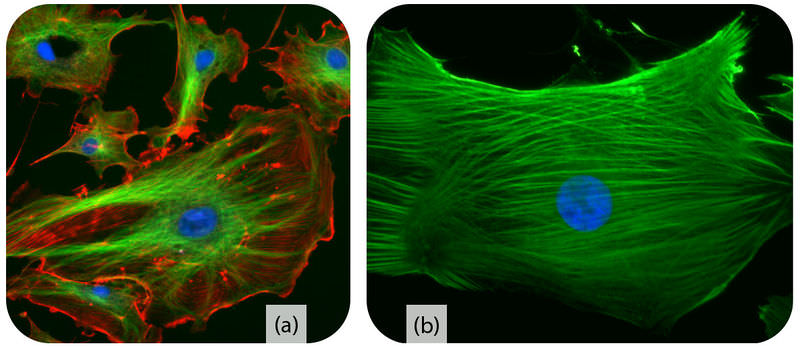 Images of cytoskeleton and microfilaments