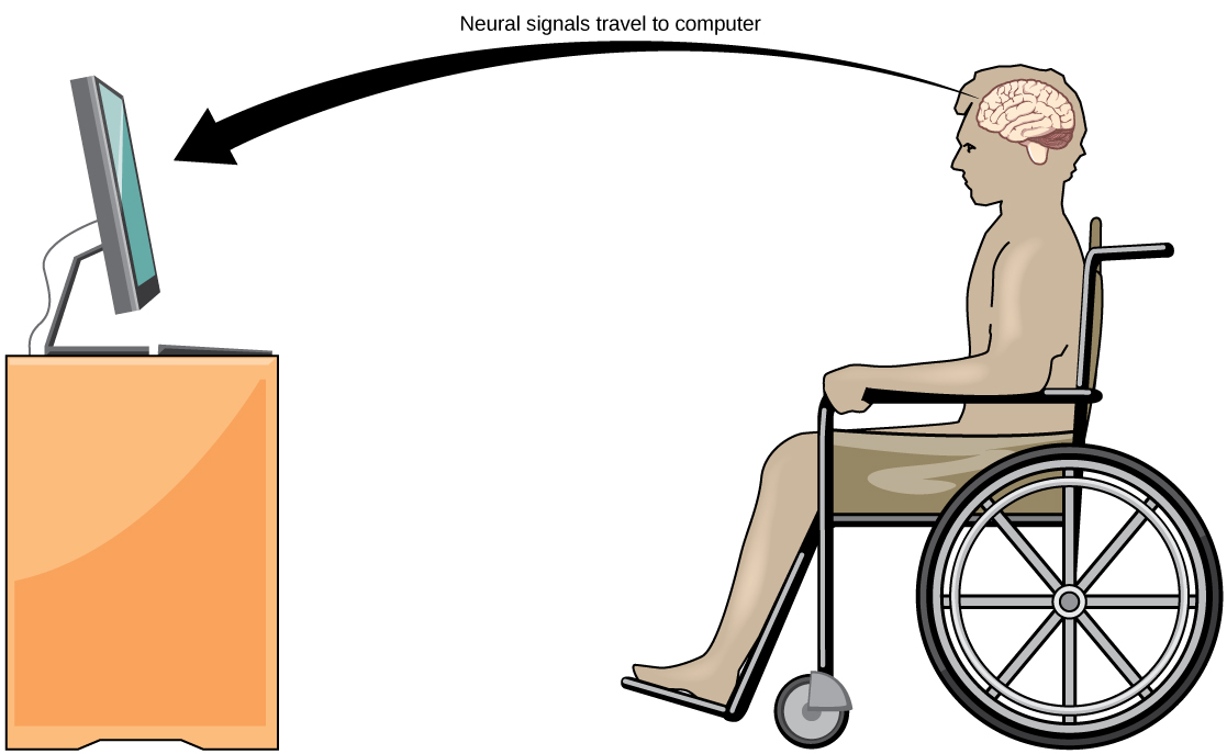 يُظهر الرسم التوضيحي شخصًا يجلس على كرسي متحرك ويواجه شاشة كمبيوتر. يشير السهم إلى أن الإشارات العصبية تنتقل من دماغ الشخص المشلول إلى الكمبيوتر.