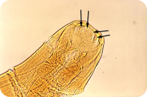 Parasitic hookworm under microscope