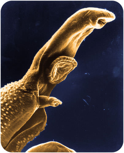 Schistosome parasite
