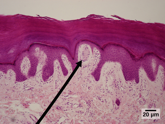 La micrographie montre l'épiderme, qui se colore en rose foncé, et le derme, qui se colore en rose clair. Des projections d'épiderme semblables à des doigts s'étendent jusqu'au derme. Entre deux de ces doigts se trouve un corpuscule de Meissner ovale d'environ dix microns de diamètre et 20 microns de long.