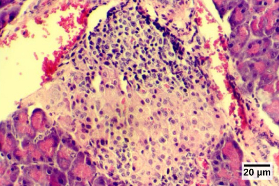 يُظهر التصوير المجهري خلايا ملطخة باللون الأرجواني في نسيج أبيض. الأنسجة البيضاء محاطة بأنسجة تلطخ باللون الوردي.