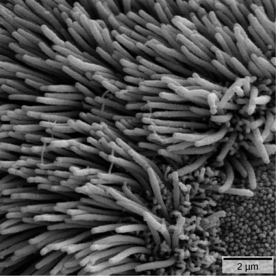 在这张显微照片中，纤毛是长而细的毛状突起。