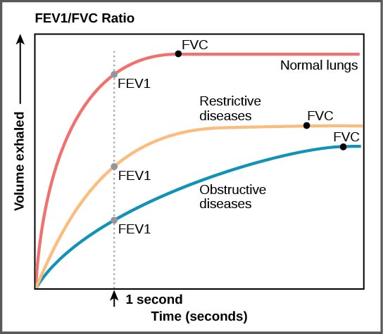 Le graphique représente le volume expiré en fonction du temps. Dans les poumons normaux, la quasi-totalité de l'air peut être exhalée de force en moins d'une seconde après avoir respiré profondément, ce qui entraîne une courbe qui monte fortement au début puis se stabilise peu après une seconde. Le volume auquel le plateau est atteint est le FVC. Dans les poumons des personnes atteintes d'une pneumopathie restrictive, la CVF est considérablement plus faible, mais la personne peut expirer assez rapidement, ce qui donne une courbe de forme similaire, mais avec un plateau, ou CVF, plus bas que celui des poumons normaux. Dans les poumons des personnes atteintes d'une maladie pulmonaire obstructive, la CVF est faible et l'expiration est beaucoup plus lente, ce qui se traduit par une courbe plus plate avec un plateau plus bas.