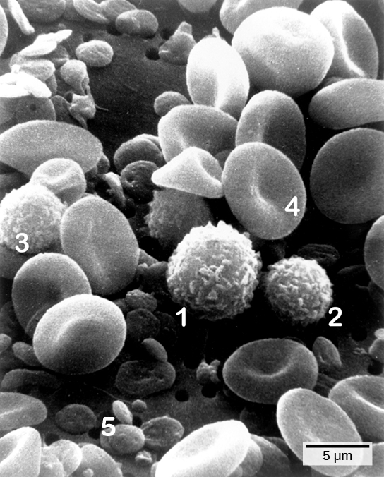 صورة مجهرية تظهر مسحة دم. خلايا الدم الحمراء على شكل قرص، ويتم ضغطها معًا في المنتصف. الخلايا الأحادية والخلايا الليمفاوية والعدلات كلها على شكل كرة وغامضة. الصفائح الدموية عبارة عن أقراص صغيرة ومسطحة.
