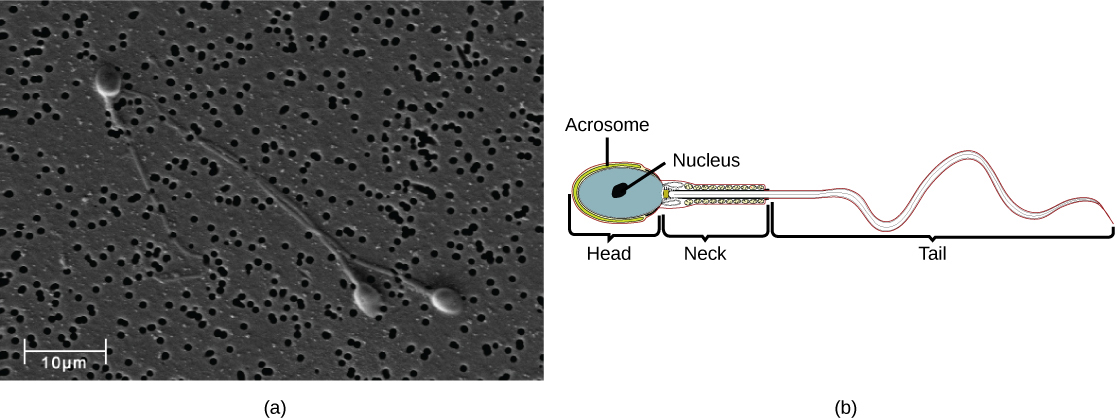La micrographie montre des spermatozoïdes humains, qui ont une tête ovale d'environ 3 microns de diamètre et un très long flagelle. L'illustration montre que la tête est entourée par l'acrosome. La partie de la queue la plus proche de la tête, appelée cou, est plus épaisse que le reste.