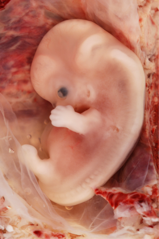 La photo montre un foetus humain, avec une grosse tête courbée, un œil noir, des doigts sur le bras et un bourgeon de patte. La colonne vertébrale est visible par le dos et l'estomac dépasse jusqu'au bourgeon de la jambe.