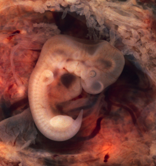 O embrião se assemelha a uma minhoca segmentada com uma cabeça protuberante.
