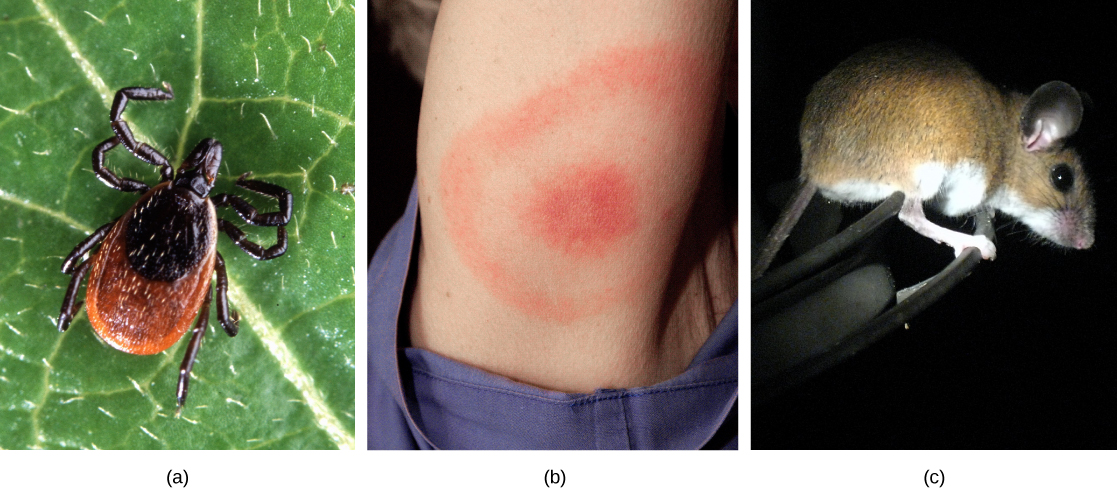  Photo (a) shows a deer tick on a leaf. The tick has a brown oval body with a smaller, round oval toward the front. The head and legs are black. Photo (b) shows an arm with a red, circular rash enclosed in a ring-like rash. Photo (c) shows a brown mouse with a white belly and legs and large, round ears.