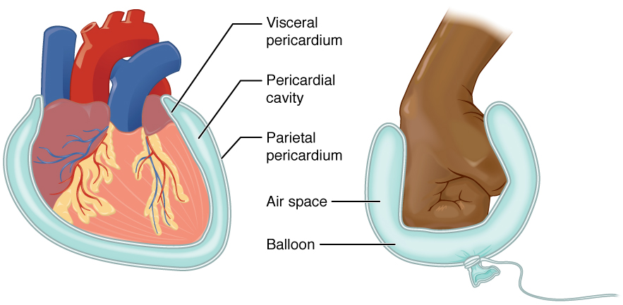 This diagram shows the pericardium on the left next to an analogy of a hand punching a balloon on the right. The pericardium is a two-layered sac that surrounds the entire heart except where the blood vessels emerge on the heart’s superior side. The pericardium has two layers because it folds over itself in the shape of the letter U. The inner layer that borders the heart is the visceral pericardium while the outer layer is the parietal pericardium. The space between the two layers is called the pericardial cavity. The heart sits in the cavity much like a fist punching into a balloon. The balloon surrounds the lower part of the fist with a two-layered sac, with the top of the balloon, where it contacts the fist, being analogous to the visceral pericardium. The bottom of the balloon, where it is tied off, is analogous to the parietal pericardium. The air within the balloon is analogous to the pericardial cavity.