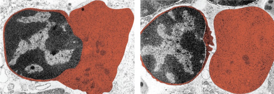 This set of micrographs shows a red blood cell extruding its nucleus. In the left panel, the nucleus is partially extruded from the red blood cell and in the right panel, the nucleus is completely extruded from the cell.