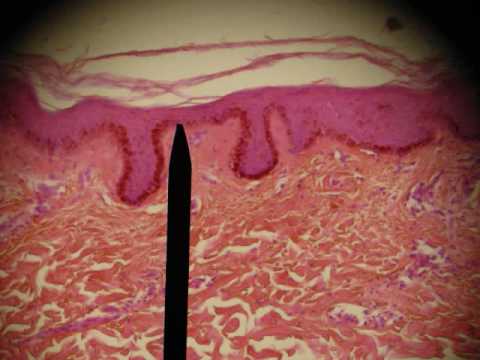 Thumbnail for the embedded element "EPITHELIAL TISSUES HISTOLOGY ANATOMY Skin; Intestine; Professor Fink"