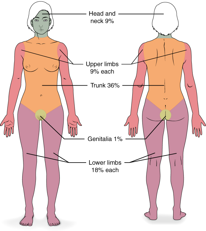 This diagram depicts the percentage of the total body area burned when a victim suffers complete burns to regions of the body. Complete burning of the face, head and neck account for 19% of the total body area. Burning of the chest, abdomen and entire back above the waist accounts for 36% of the total body area. Anterior and posterior surfaces of the arms and hands account for 18% of the total body area (9% for each arm). The anterior and posterior surface of both legs, along with the buttocks, accounts for 36% of the total body area (18% for each leg). Finally, the anterior and posterior surfaces of the genitalia account for 1% of the total body area.