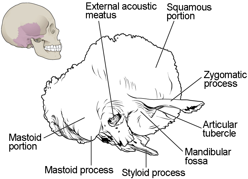 This image shows the location of the temporal bone. A small image of the skull on the top left shows the temporal bone highlighted in pink and a magnified view of this region then highlights the important parts of the temporal bone.