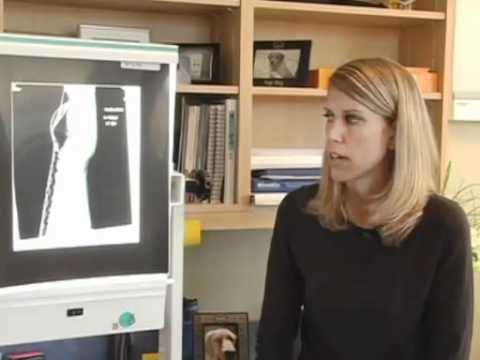 Thumbnail for the embedded element "Dr. Kristin Nesbitt at MMI - Colles Fracture"