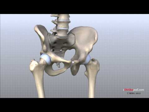 Thumbnail for the embedded element "Hip Anatomy Animated Tutorial"