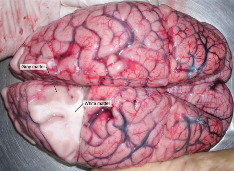 This photo shows an enlarged view of the dorsal side of a human brain. The right side of the occipital lobe has been shaved to reveal the white and gray matter beneath the surface blood vessels. The white matter branches though the shaved section like the limbs of a tree. The gray matter branches and curves on outside of the white matter, creating a buffer between the outer edges of the occipital lobe and the internal white matter.