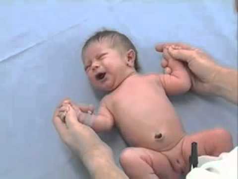 Thumbnail for the embedded element "Newborn examination Reflexes"