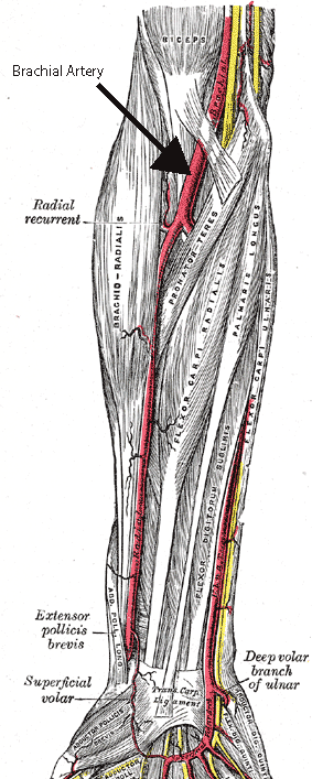 The image shows some of the muscles and arteries of the right forearm and hand, including the superficial palmar arch (titled Superficial Volar Arch in this picture, which is an alternative term) and the common palmar digital arteries branching off of it. The unlabelled yellow lines are nerves. Palmar aspect with the proximal part (elbow) at the top and the distal part (hand) at the bottom.