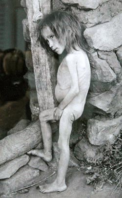 Child affected by famine in Buguruslan, Russia in 1921