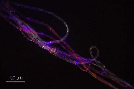 Roots hairs of soybean fluoresce under the microscope when stained with Nile red.