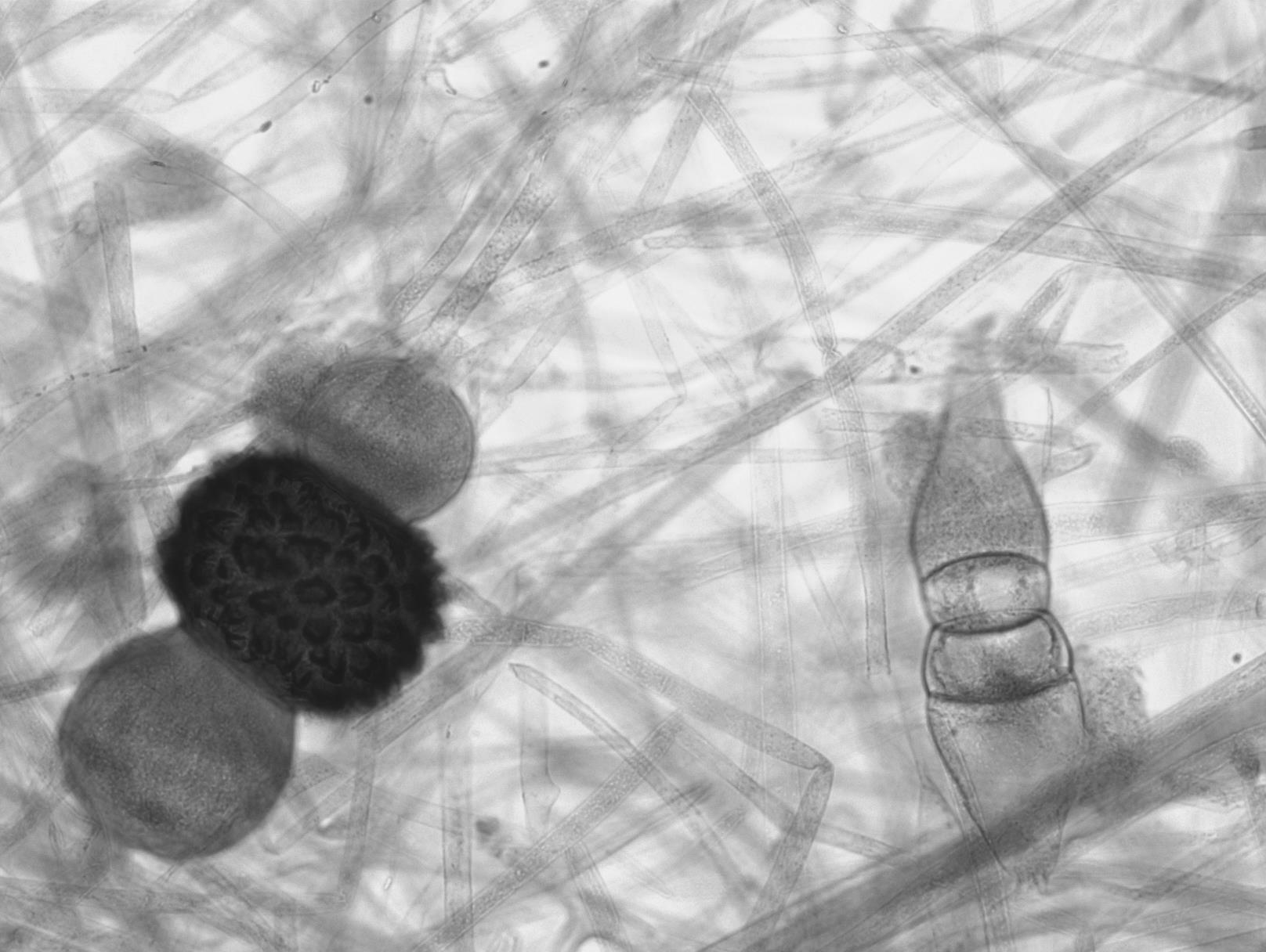 Rhizopus stolonifer formando cigosporangios