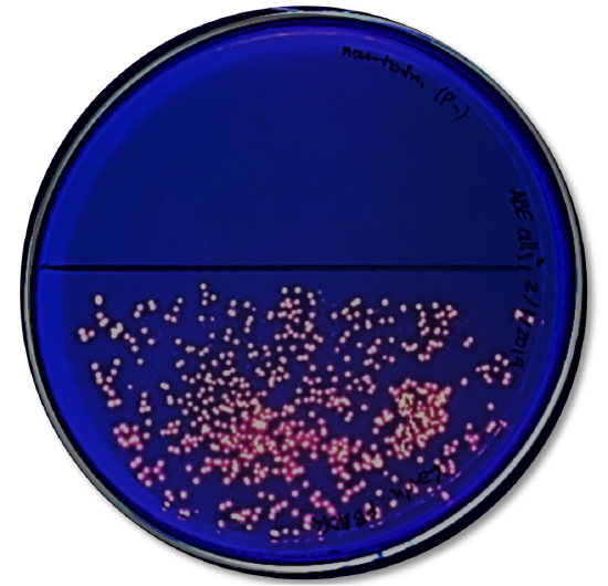 photo showing glowing E. coli colonies that have been transformed with a gene for a fluorescent protein on 1/2 of a petri dish.