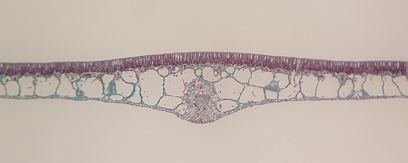 A cross section through a water lily (Nymphaea) leaf