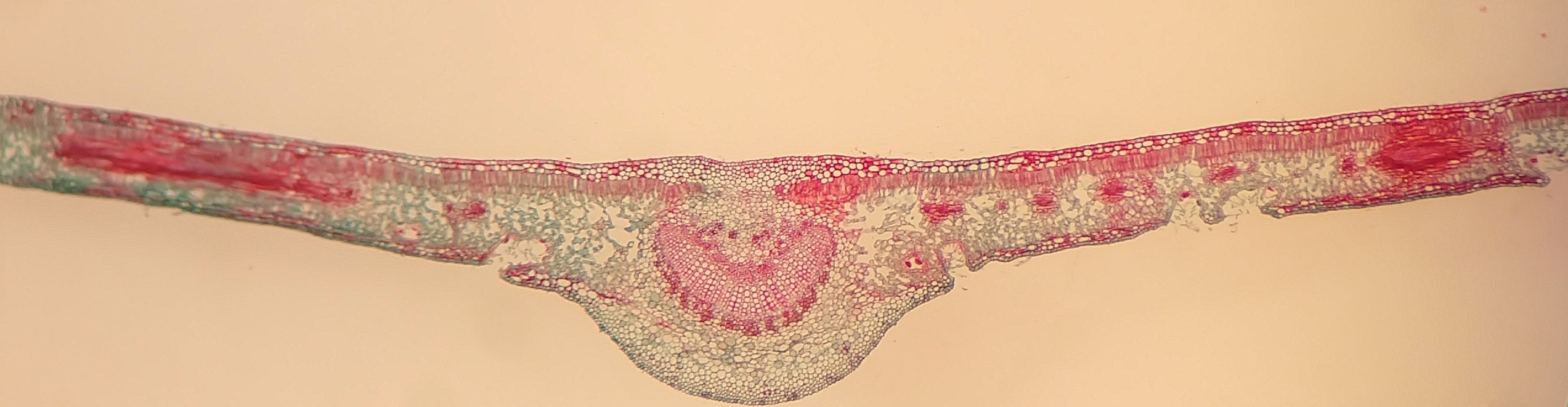 A cross section through a xerophytic leaf, unlabeled