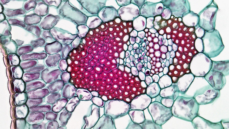 Paquete vascular de yuca con muchas células de esclerénquima