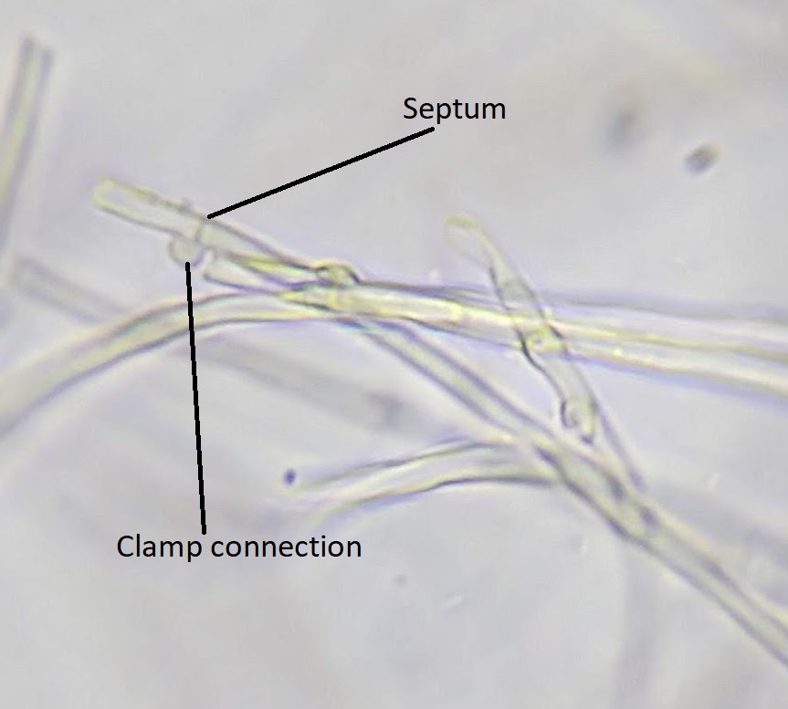 Una conexión de pinza y tabique etiquetados en una imagen de hifas de un microscopio