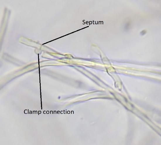 A clamp connection and septum labelled in an image of hyphae from a microscope