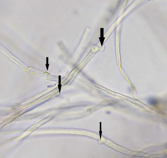 Hyphae from a microscope with arrows indicating clamp connections