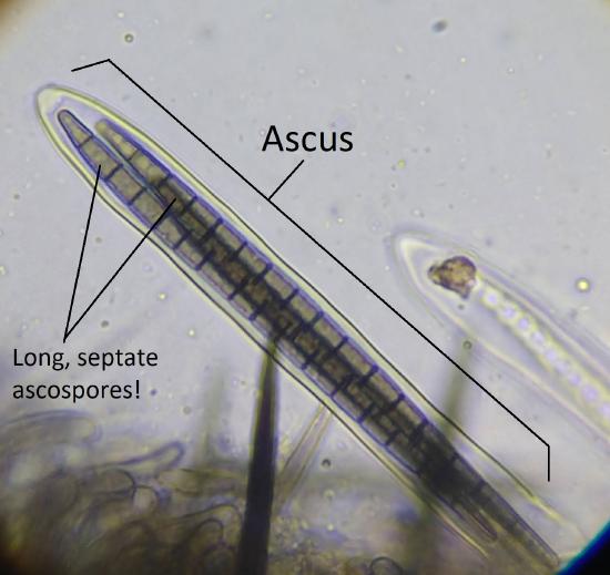 An ascus with several long, septate ascospores inside it
