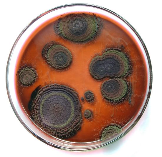 A petri plate with multiple mold colonies