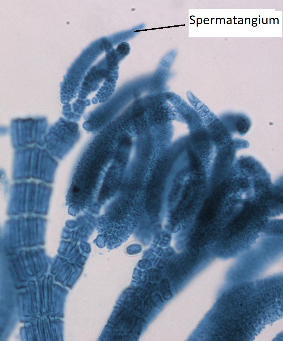 Gametofito masculino de Polysiphonia con un espermatangium etiquetado