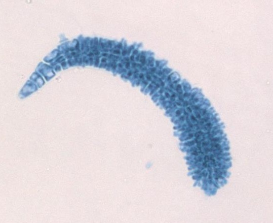 A close up of a spermatangium from a male gametophyte