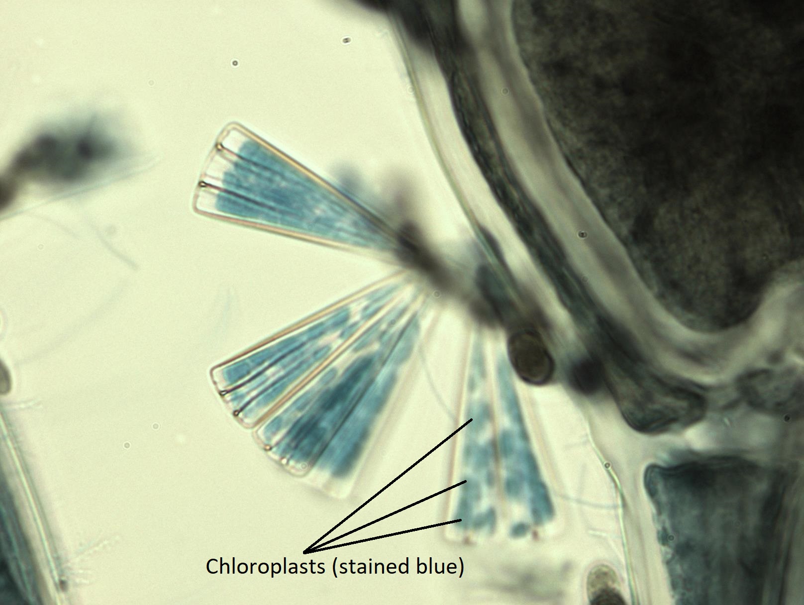 Epiphytic diatoms attached to a red algae. The chloroplasts are stained blue and indicated in the picture.